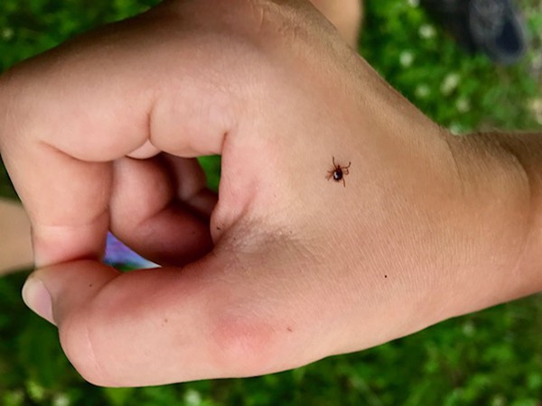 A sick on a human hand